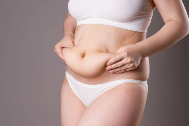 Tummy tuck clinic in Balewadi